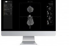 AI breast cancer detection platform